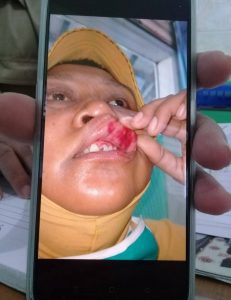 Berkas Laporan Penganiayaan Diduga Dipetieskan di Polres Gresik
