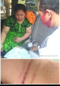 KDRT Warga Desa Kumalasa Berlanjut ke Ranah Hukum