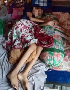 Mahasiswi UNIGRES Asal Pulau Bawean Terkapar Setelah Divaksin di RSUD. Ibnu Sina