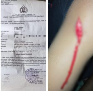 Gegara Memakai Kaos Berlogo Perguruan Pencak Silat 6 Pemuda Dikeroyok Puluhan Orang Tak Dikenal