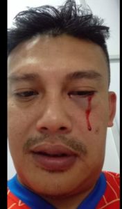 SEORANG WARTAWAN DIPUKUL OKNUM POLANTAS HINGGA TERLUKA DAN BERDARAH