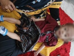 Diduga Kurang Gizi dan Infeksi Paru-Paru, Kondisi Balita Asal Warga Desa Tanjungori Sangat Memprihatinkan