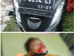 Honda PCX Seruduk Jupiter Z di Jln Raya Burlanjang, 3 Pengendara Luka Berat