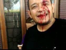 Seorang Jurnalis Jadi Korban Kekerasan Oknum LSM Hingga Luka Robek di Pelipis Mata Kiri