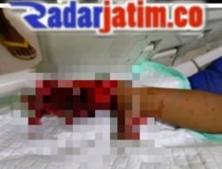 Remaja Asal Desa Plemahan Sumobito Alami Luka Parah Akibat Ledakan Petasan